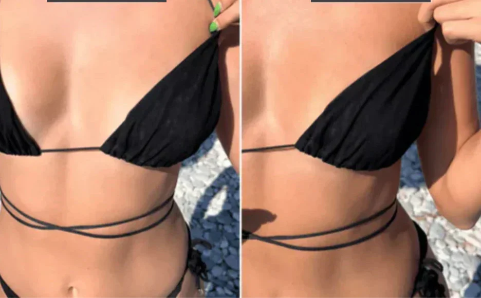 Leona™ - Bräunungs-Bikini